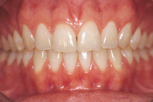 dentista cassino denti sorriso